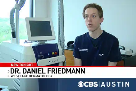 A new laser treatment for acne is getting dramatic and long-lasting results